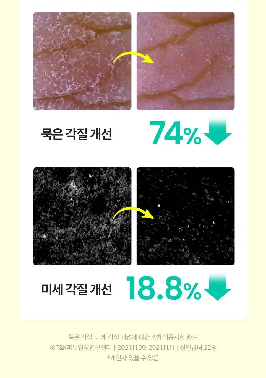 [1등필링/화잘먹] 닥터지 브라이트닝 필링젤 기획 (120g+60g+히알시카세럼2ml/120g+120g+10g) 상세페이지 15